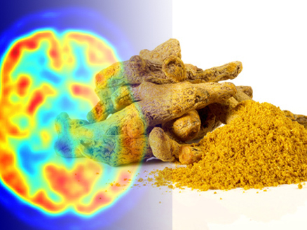 Image result for curcumin in alzheimers